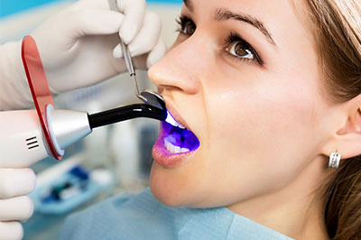 Astoria Modern Family Dental | Root Canals, Oral Cancer Screening and Teeth Whitening