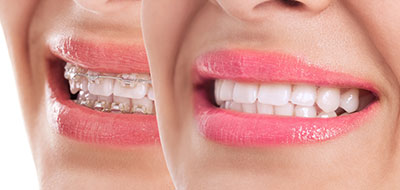 Astoria Modern Family Dental | Dentures, Night Guards and Oral Exams