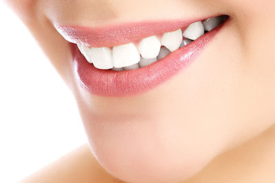 Astoria Modern Family Dental | Implant Dentistry, Sports Mouthguards and Implant Restorations