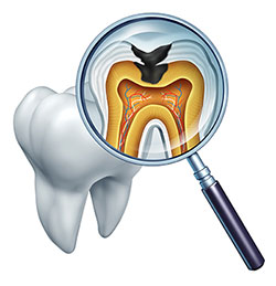 Astoria Modern Family Dental | Implant Restorations, Root Canals and Snoring Appliances