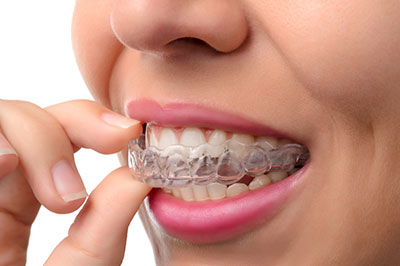 Astoria Modern Family Dental | All-on-4 reg , Oral Exams and Dental Lab