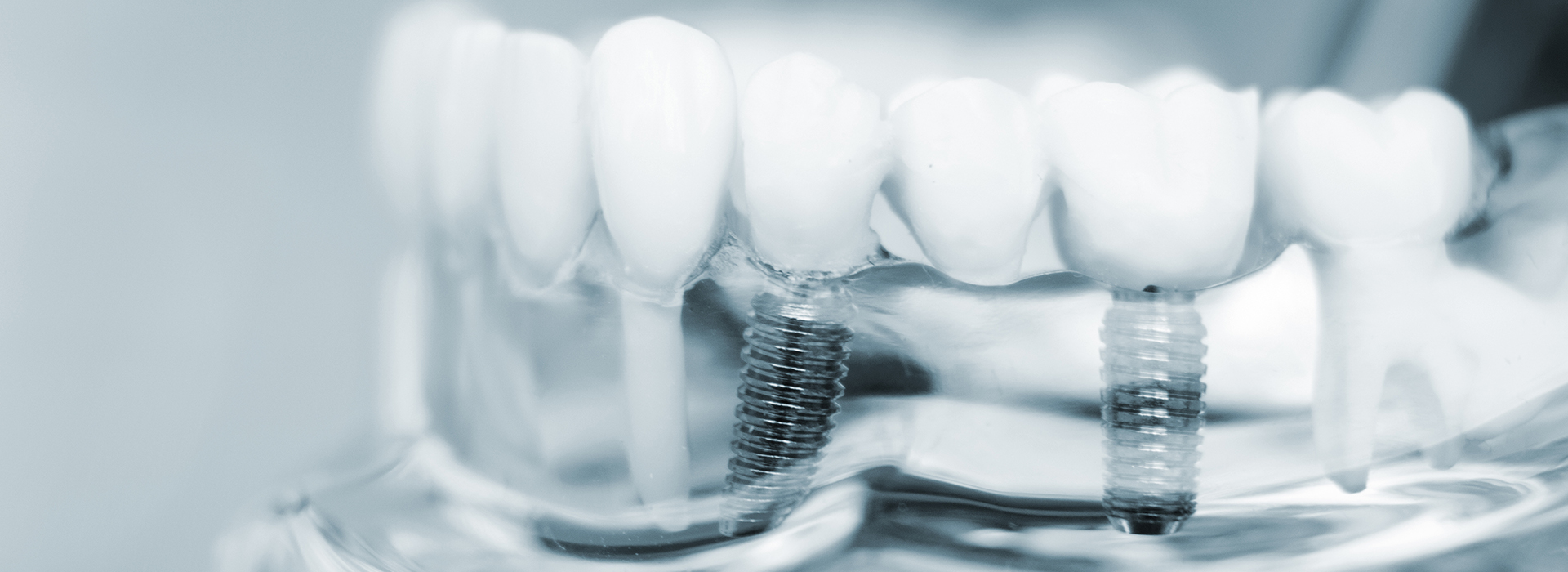 Astoria Modern Family Dental | Oral Cancer Screening, Root Canals and Ceramic Crowns