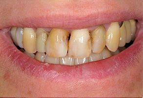 Astoria Modern Family Dental | Laser Dentistry, Implant Restorations and All-on-4 reg 