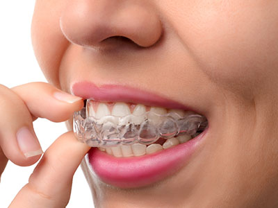 Astoria Modern Family Dental | Pediatric Dentistry, Invisalign reg and Ceramic Crowns