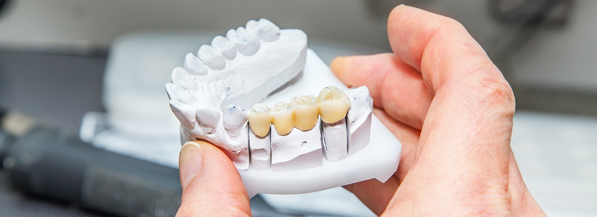 Astoria Modern Family Dental | Ceramic Crowns, Invisalign reg and Emergency Treatment